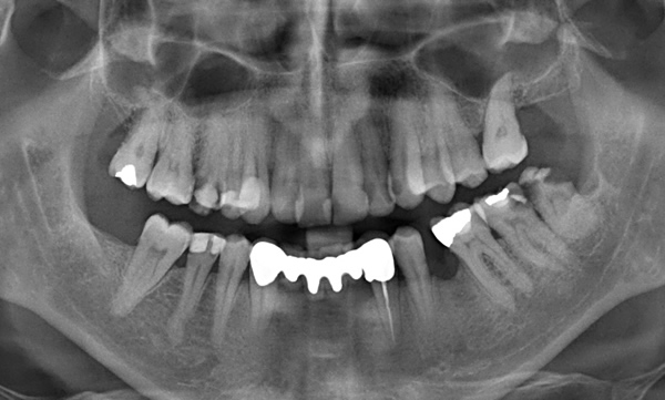 Radiología Digital